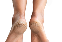 Load image into Gallery viewer, Minty Pleasure 4 oz. Foot Scrub